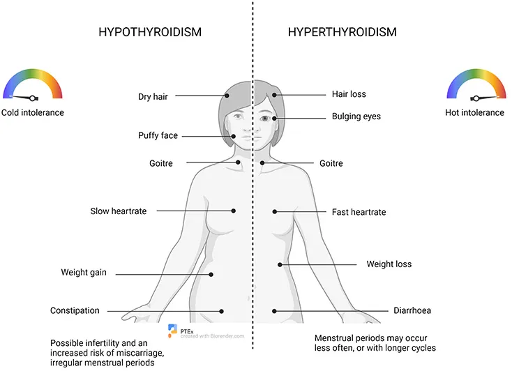 علائم کم کاری و پرکاری تیروئید