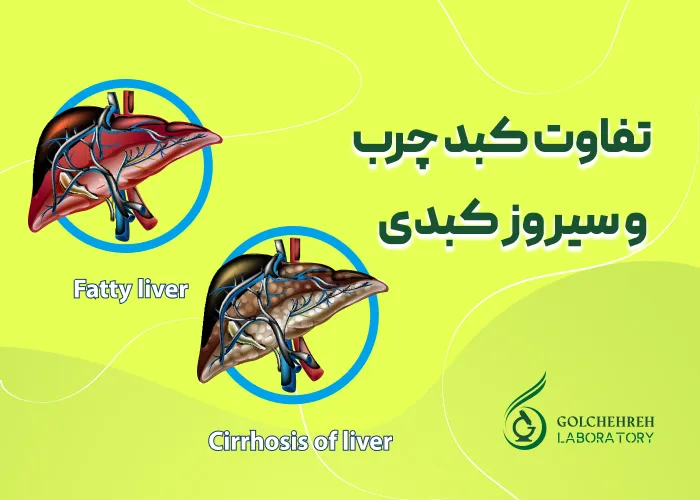 تفاوت کبد چرب و سیروز کبدی