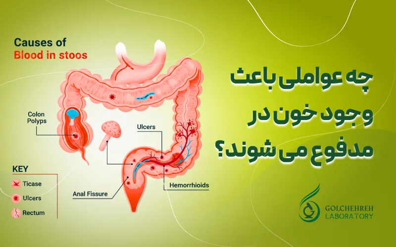 چه عواملی باعث وجود خون در مدفوع می‌ شوند؟
