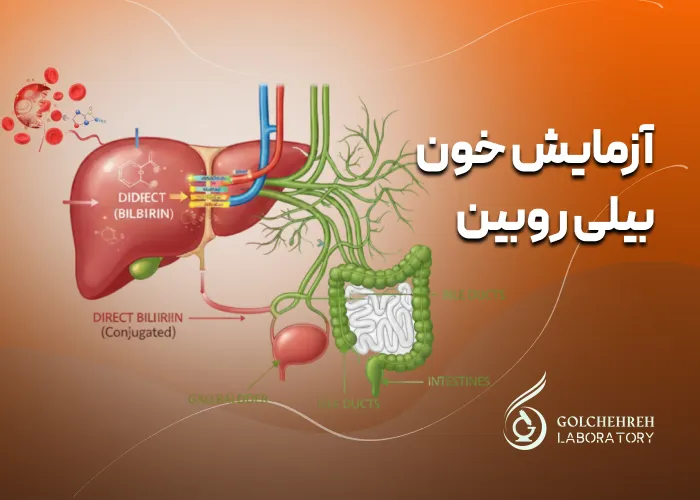 آزمایش خون بیلی روبین: ضرورت، نحوه انجام و تفسیر نتایج