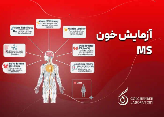 آزمایش خون MS: تشخیص، علائم، نحوه انجام و تفسیر